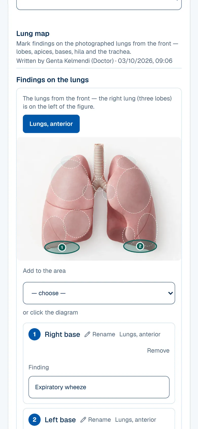 The Pulmonology screen in OPALEVI